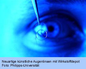 Neuartige Augenlinsen mit Wirkstoffdepot
