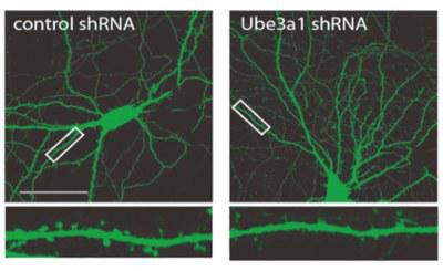 Neuro_RNA