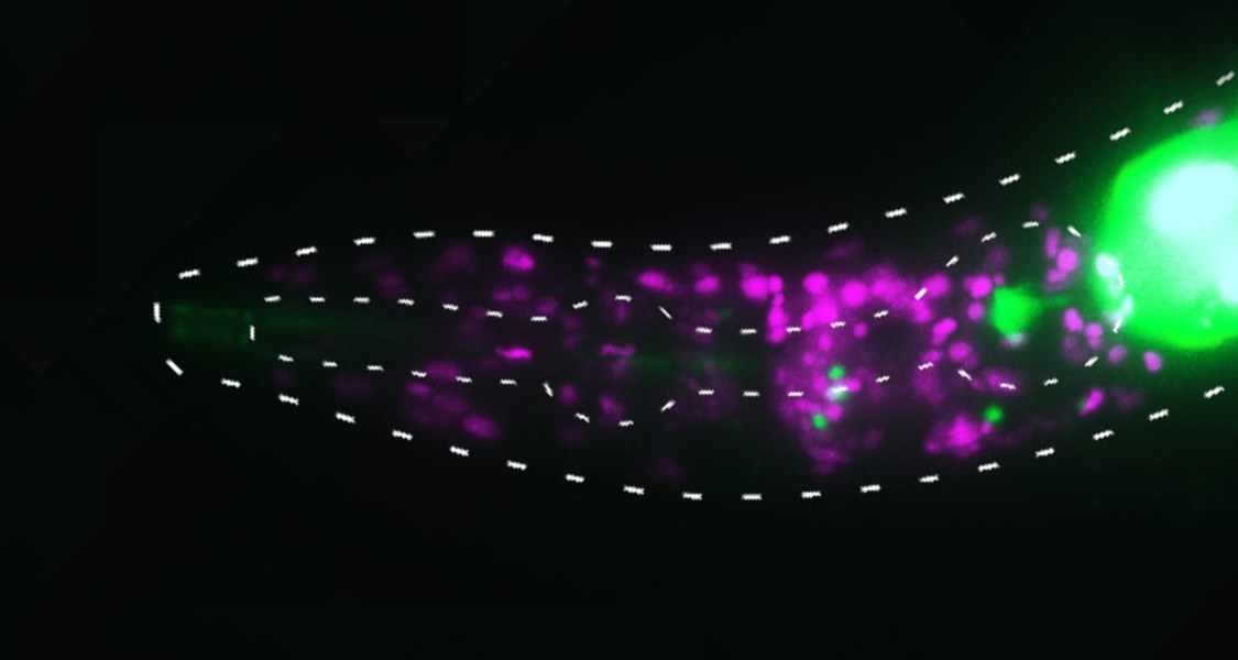 Mittels fluoreszierender Moleküle zeigte das Team um Henrik Bringmann, welche Gene in Schlafneuronen des Fadenwurms aktiv sind.