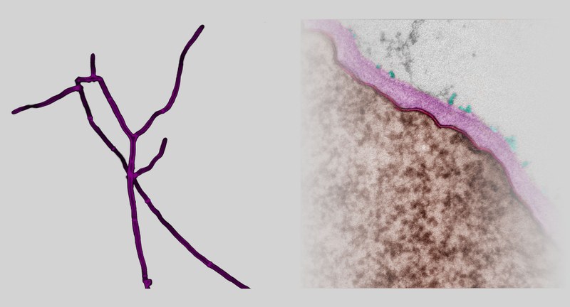 Hyphen des filamentösen Pilzes Chaetomium thermophilum nach Einfärbung durch einen Chitin-bindenden Farbstoff (purpurn). Rechts ist ein elektronenmikroskopischer Ausschnitt der Chaetomium-Zellwand (purpurn) gezeigt. Dfg5-Enzyme bewirken die Übertragung von Zellwandproteinen (grün) aus der Plasmamembran (rot) auf Zuckerstränge der Oberfläche.