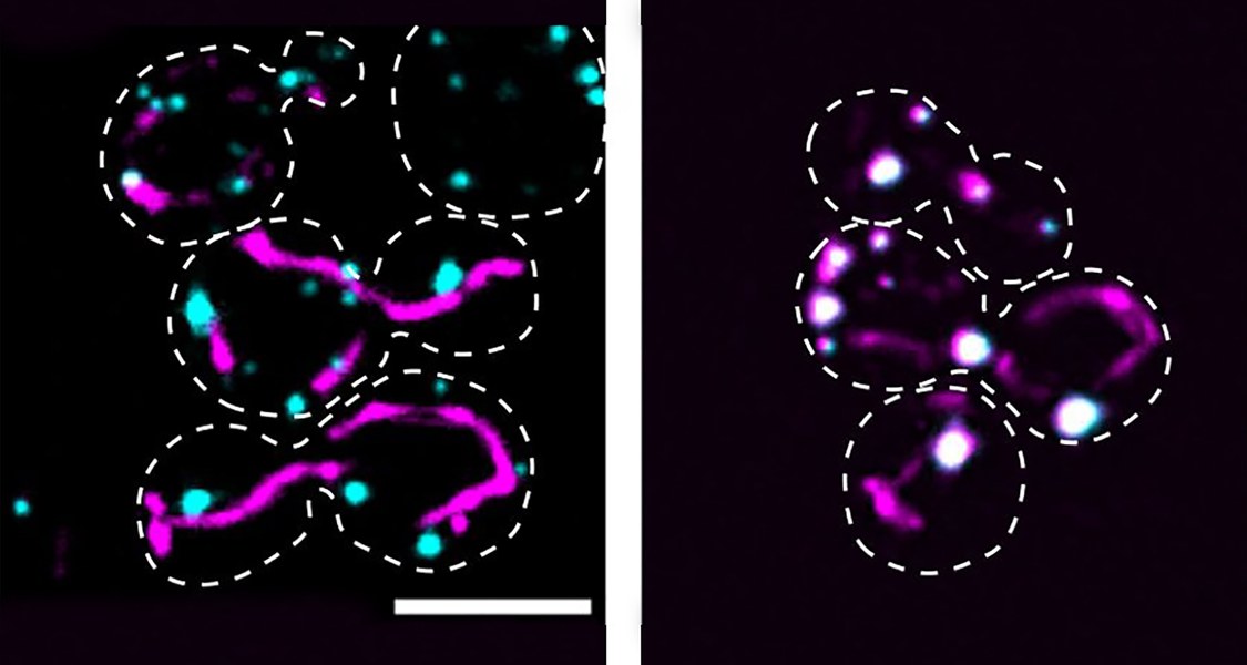 Ein Protein, zwei Einsatzorte (rechtes Bild): Wie Leuchtfarbstoffe sichtbar machen, befindet sich das Protein Ptc5 (magenta) nicht bloß in den Mitochondrien von Hefezellen (gestrichelt umrandet), sondern auch in den Peroxisomen, wo die Fluoreszenz durch Überlagerung weiß erscheint. Entfernt man das peroxisomale Transportsignal aus dem Protein, gelangt dieses nicht in das Organell (links).