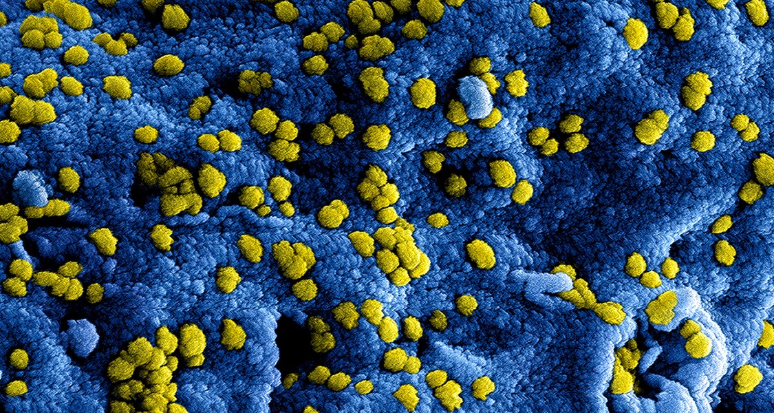 Foto von MERS-Coronaviruspartikeln