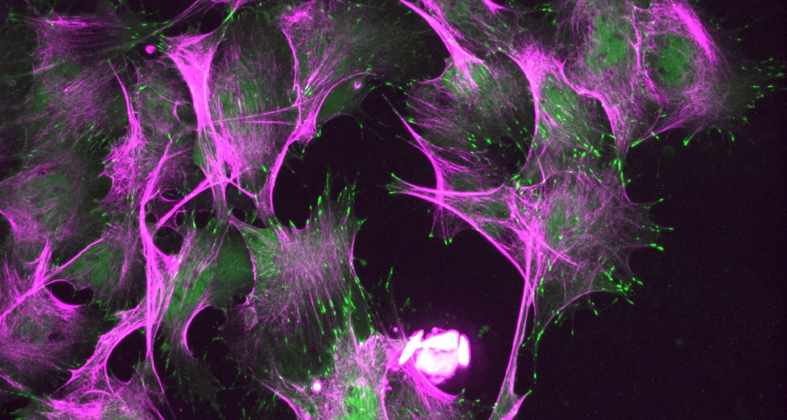 Die Vorläufer von Muskelfasern bilden Zellfäden (grün), um sich im Verband fortzubewegen; die Fasern des Zellskeletts sind violett angefärbt.