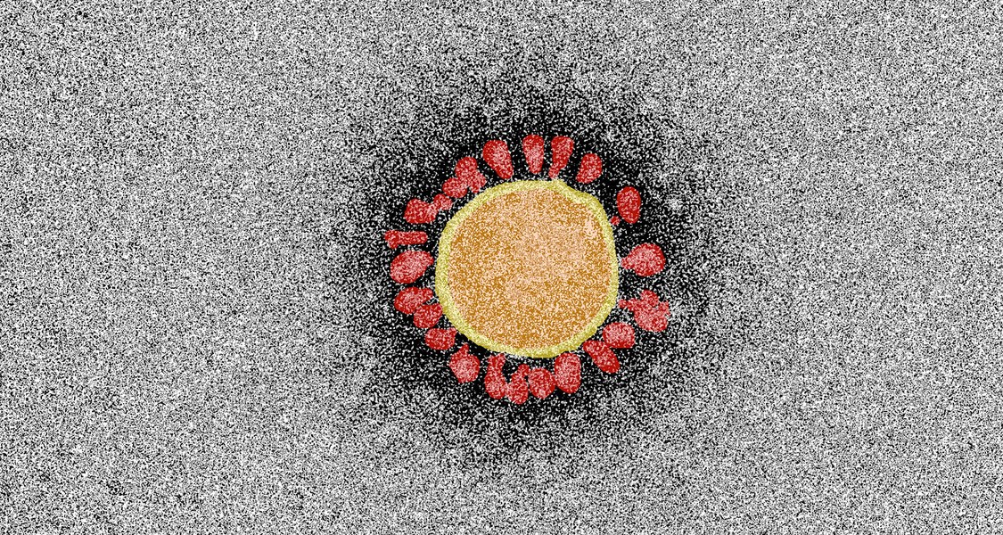 Aufnahme des Virus, coloriert in Rot