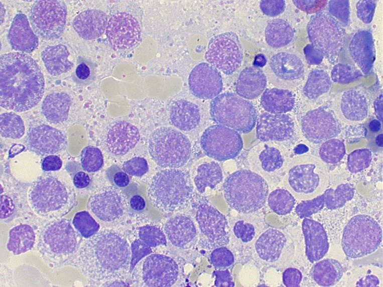 Abbildung von myeloischen Zellen