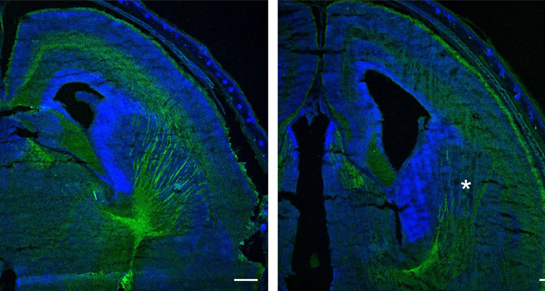 Schaltet man das Protein CAP1 aus (Bild rechts), so bilden sich im Gehirn weniger Nervenfasern (grün gefärbt) als normalerweise (Bild links). Das Sternchen in der mikroskopischen Aufnahme zeigt, wo Nervenfasern fehlen. Foto: Felix Schneider