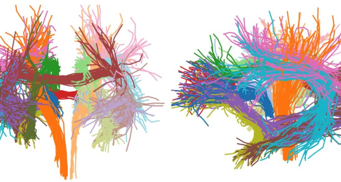 Das Gehirn von Neugeborenen enthält eine Vielzahl von Nervenbahnen, die ein Team aus der Neurowissenschaft mit Magnetresonanztomografie untersucht hat. Abbildung: Mareike Grotheer