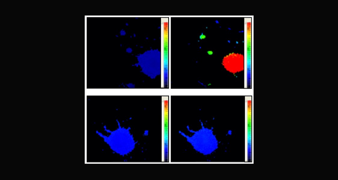 Die Eigenschaften einer Hirnzelle aus dem Blauen Kern ändert sich drastisch (Farbumschlag von blau zu rot), nachdem das Schädlingsvertilgungsmittel Rotenon zugegeben wurde, das die Bedingungen einer Parkinsonerkrankung imitiert (obere Reihe). Aktiviert man hingegen Ionenkanäle durch Verabreichung eines Wirkstoffs (untere Reihe), so bleibt die Umstellung aus (untere Reihe). Foto & Bearbeitung: Dr. Aytuğ Kiper / Creative Commons 4.0