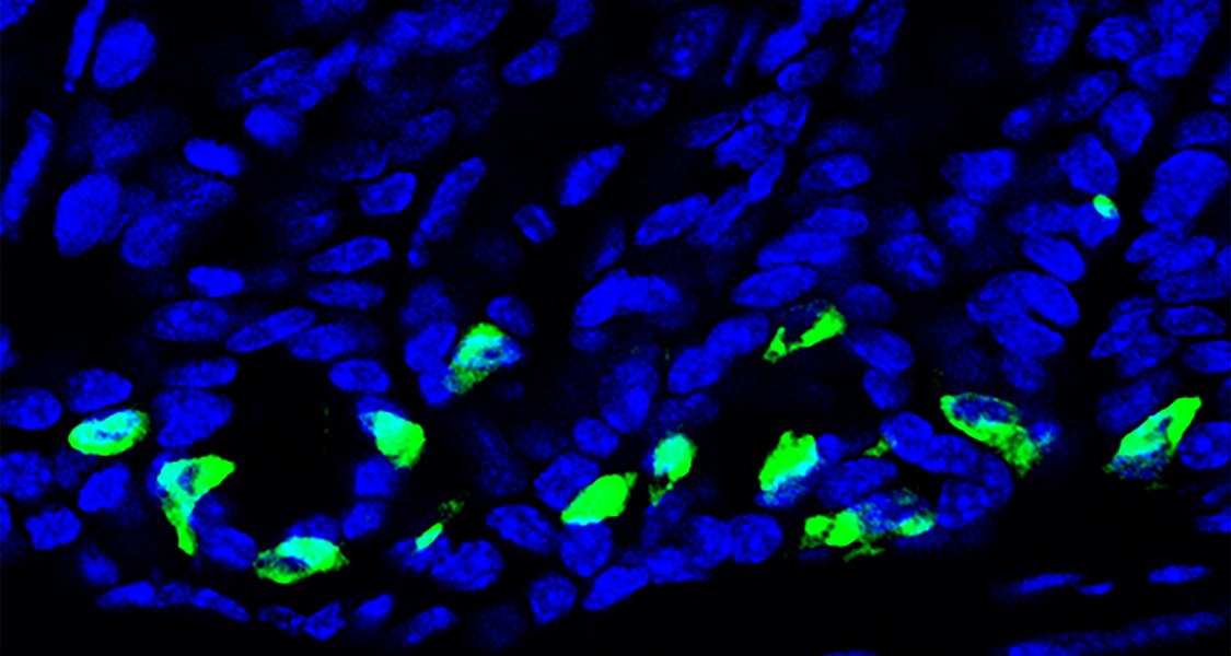 Die mikroskopische Aufnahme zeigt die Magenschleimhaut mit grün gefärbten Gastrin-produzierenden Zellen. (Foto: Rui Xu