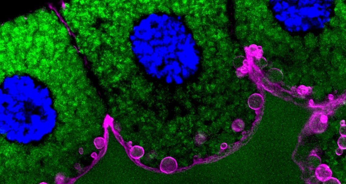 Das mikroskopische Bild einer Speicheldrüse zeigt in grün drei sekretorische Zellen mit ihren blau gefärbten Zellkernen. Die violette Färbung kennzeichnet das Protein EFhD2/Swip-1 von sekretorischen Vesikeln, die ihren Inhalt nach unten in den Innenraum der Drüse abgeben. (Foto: Franziska Lehne