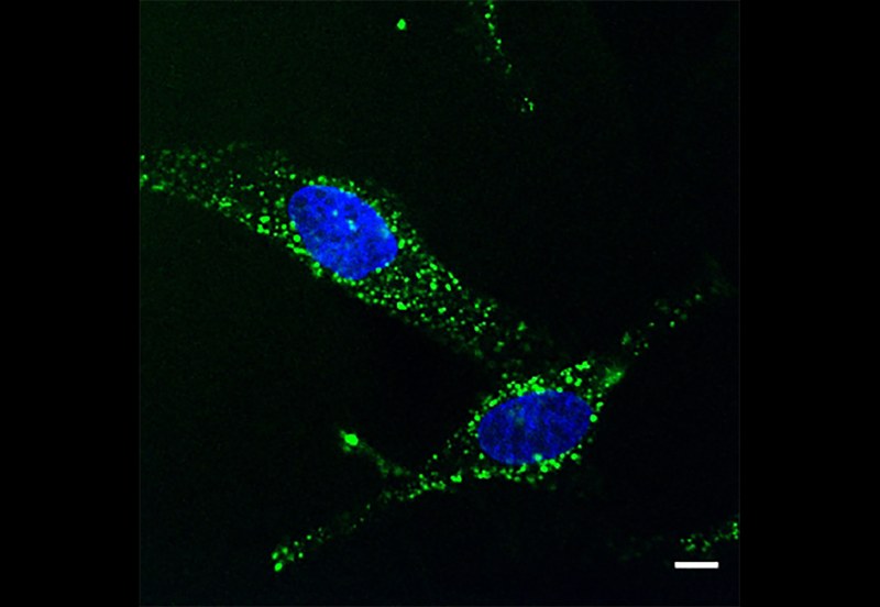 Aufnahme von Monobodies (grün angefärbt) in Krebszellen. Die Lage des Zellkerns kann man mittels eines blauen DNA-Farbstoffs erkennen. (Foto: Oliver Hantschel)