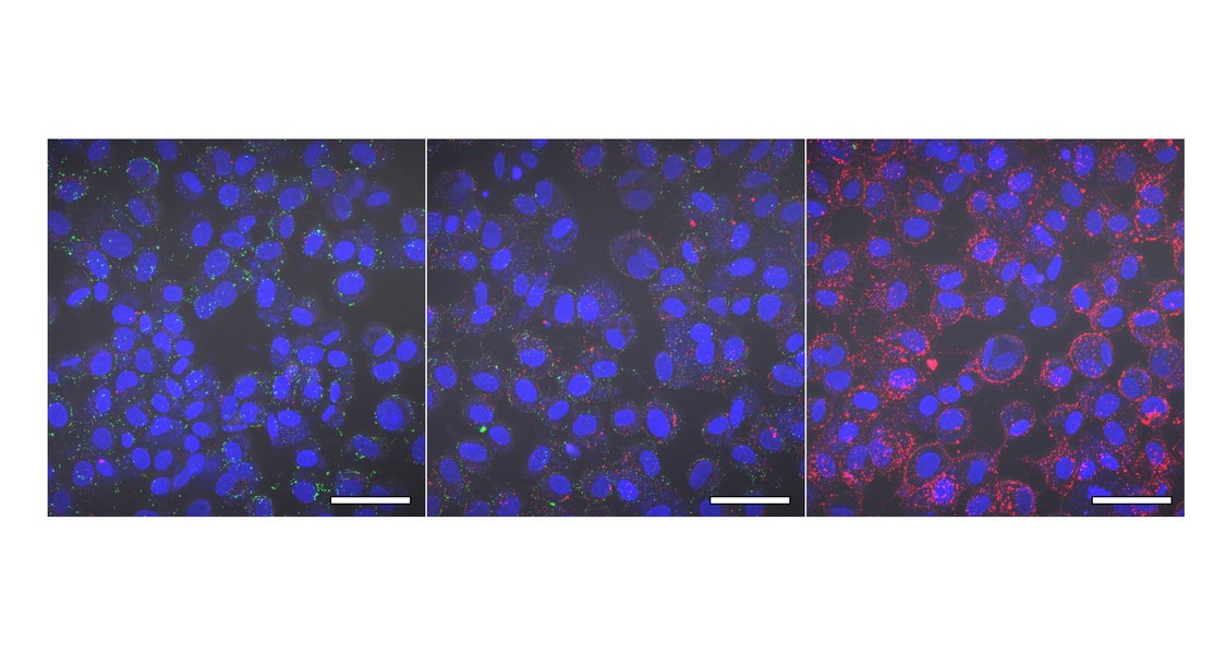 Anheftung von Zika-Viruspartikeln (grün) und extrazellulären Vesikeln aus Samenflüssigkeit (rot) an Zielzellen (Zellkerne in blau). Bei geringen Vesikel-Konzentrationen (links) können sich Viren problemlos an die Zelle anheften und diese infizieren, bei steigenden Konzentrationen der Vesikel wird der Zugang der Viren zu den Bindestellen jedoch zunehmend verhindert und eine Infektion unterbunden. Skala = 20 μM. (Foto: Rüdiger Groß