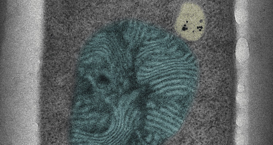 Zwischen Organellen wie Mitochondrien (im elektronenmikroskopischen Bild blau gefärbt) und Peroxisomen (gelblich) kommt es zu Kontakten, wobei Proteine beteiligt sind, die Adressanhänger für beide Organelltypen tragen. (Foto: Elena Bittner und Dr. Thomas Heimerl
