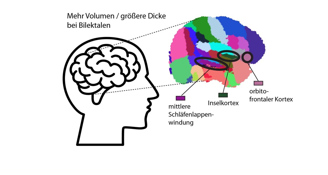 schematische Darstellung des Gehirns in unterschiedlichen Farben mit Hervorhebung und Beschreibung von drei Hirnarealen, die bei Bilektalen mehr Volumen bzw. eine größere Dicke haben: mittlere Schläfenlappenwindung, Inselkortex und orbito-frontaler Kortex