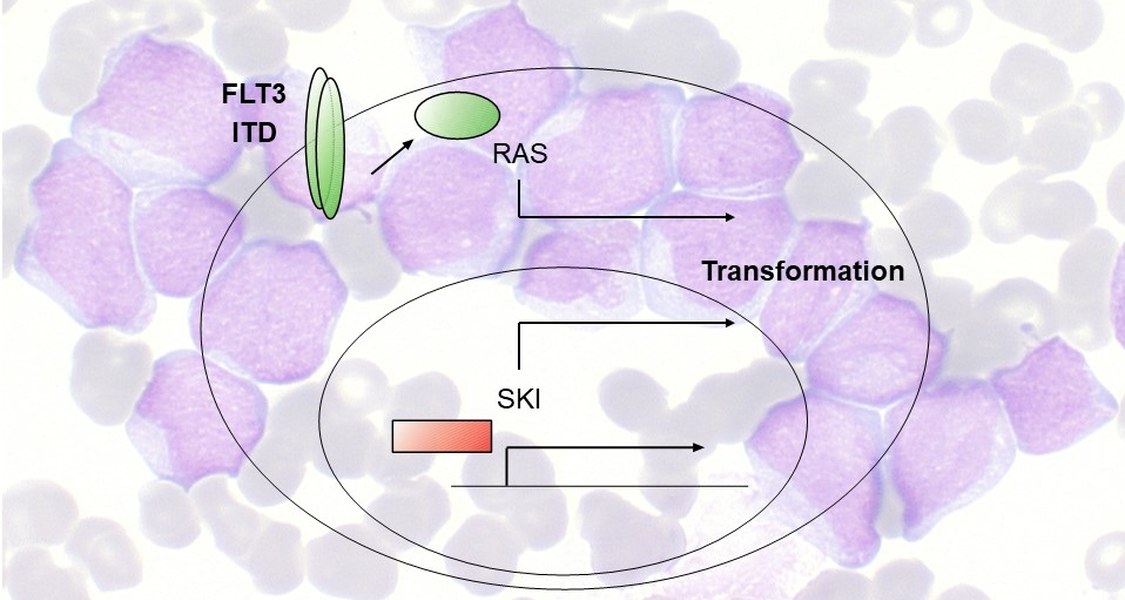 Modell einer Krebserkrankung der Plasmazellen