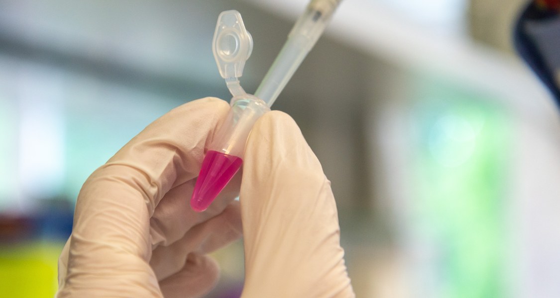 Pipette im Labor