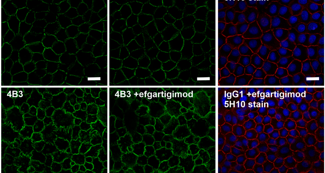 Figure from Tikkanen et al. Cells, 2022.