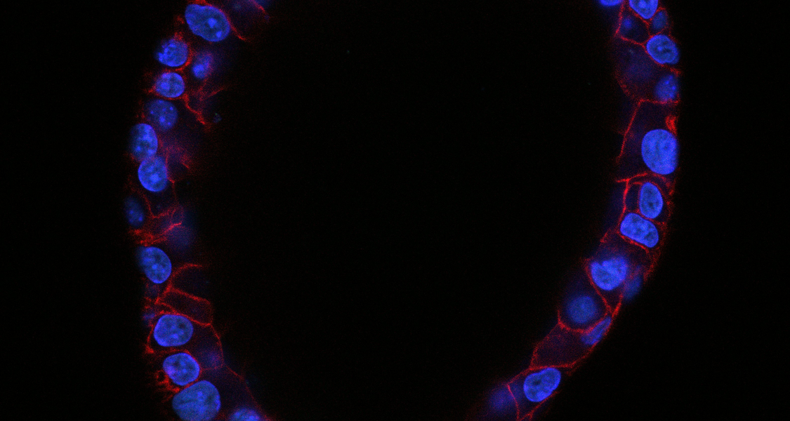 microscopic view of an organoid